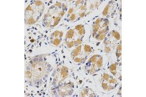Immunohistochemistry (IHC) image for anti-Glutaredoxin 1 (GRX1) antibody (ABIN1876503) (Glutaredoxin 1 antibody)