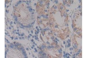 Detection of NPHN in Human Stomach Tissue using Polyclonal Antibody to Nephrin (NPHN) (Nephrin antibody  (AA 23-92))