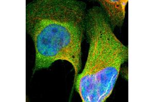 Immunofluorescent staining of human cell line U-2 OS shows localization to nucleoplasm & plasma membrane.