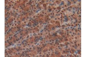 Detection of MYH6 in Rat Stomach Tissue using Polyclonal Antibody to Myosin Heavy Chain 6, Cardiac Muscle, Alpha (MYH6)