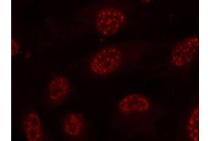 Immunofluorescence (IF) image for anti-Mitogen-Activated Protein Kinase-Activated Protein Kinase 2 (MAPKAPK2) (pThr334) antibody (ABIN1870393) (MAPKAP Kinase 2 antibody  (pThr334))