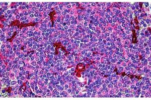 Human Spleen: Formalin-Fixed, Paraffin-Embedded (FFPE) (C5AR1 antibody)