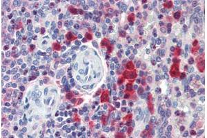 Human Spleen (formalin-fixed, paraffin-embedded) stained with CASP3 antibody ABIN462092 at 10 ug/ml followed by biotinylated goat anti-rabbit IgG secondary antibody ABIN481713, alkaline phosphatase-streptavidin and chromogen. (Caspase 3 antibody)