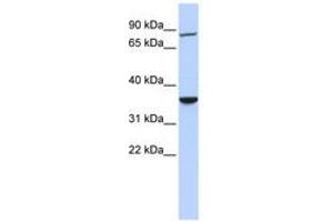 Image no. 1 for anti-RING Finger Protein 207 (RNF207) (AA 36-85) antibody (ABIN6740830) (RNF207 antibody  (AA 36-85))