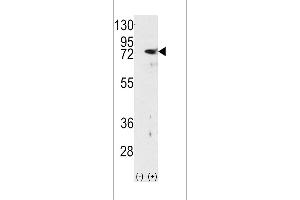 Western blot analysis of PKC delta using rabbit polyclonal PKC delta Antibody using 293 cell lysates (2 ug/lane) either nontransfected (Lane 1) or transiently transfected with the PRKCD gene (Lane 2). (PKC delta antibody  (N-Term))