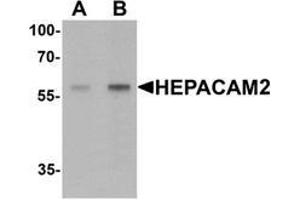 Western blot analysis of HEPACAM2 in mouse brain tissue lysate with HEPACAM2 Antibody  at (A) 0. (HEPACAM2 antibody  (C-Term))