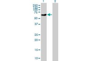 Western Blot analysis of XRCC4 expression in transfected 293T cell line by XRCC4 MaxPab polyclonal antibody. (XRCC4 antibody  (AA 1-336))
