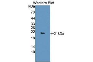 Detection of Recombinant TNFa, Human using Polyclonal Antibody to Tumor Necrosis Factor Alpha (TNFa) (TNF alpha antibody  (AA 77-233))