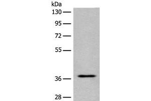 Western blot analysis of Jurkat cell lysate using EN2 Polyclonal Antibody at dilution of 1:400 (EN2 antibody)