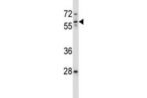 ICAM3 antibody western blot analysis in ZR-75-1 lysate. (ICAM-3/CD50 antibody  (AA 282-310))