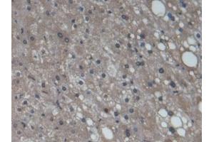 Detection of CYP3A7 in Human Liver Tissue using Monoclonal Antibody to Cytochrome P450 3A7 (CYP3A7) (CYP3A7 antibody  (AA 344-497))