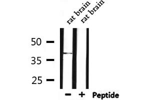 Western blot analysis of extracts from rat brain, using ACP5 Antibody. (ACP5 antibody  (N-Term))