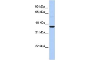 Western Blotting (WB) image for anti-Zinc Finger CCCH-Type Containing 15 (ZC3H15) antibody (ABIN2463354) (ZC3H15 antibody)