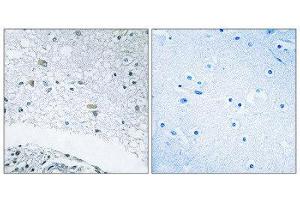 Immunohistochemistry (IHC) image for anti-Laminin, gamma 3 (LAMC3) (C-Term) antibody (ABIN1850460) (LAMC3 antibody  (C-Term))