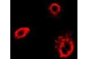 Immunofluorescent analysis of TCP1-delta staining in Hela cells. (CCT4 antibody)