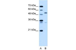 PODXL antibody used at 5 ug/ml to detect target protein. (PODXL antibody  (N-Term))