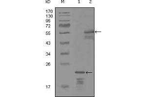Western blot analysis using ERBB3 mouse mAb against truncated Trx-ERBB3 recombinant protein (1) and MBP-ERBB3 (aa1175-1275) recombinant protein (2). (ERBB3 antibody)