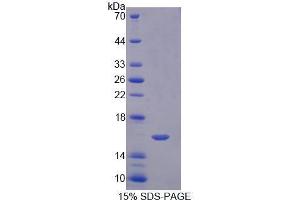 SDS-PAGE analysis of Human Neuropilin 1 Protein.