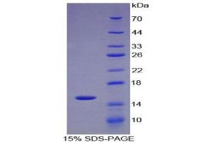 SDS-PAGE (SDS) image for Spectrin alpha Chain, Brain (SPTAN1) (AA 289-408) protein (His tag) (ABIN1078774) (SPTAN1 Protein (AA 289-408) (His tag))