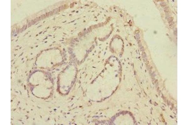 KCTD6 antibody  (AA 1-237)