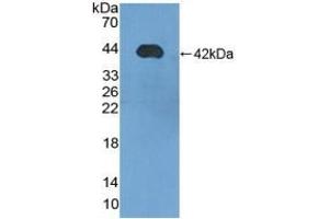 Detection of Recombinant LIPB, Human using Polyclonal Antibody to Lipophilin B, Prostatein Like (LIPB) (Lipophilin B antibody  (AA 22-90))