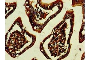 Immunohistochemistry of paraffin-embedded human small intestine tissue using ABIN7147319 at dilution of 1:100 (GPA33 antibody  (AA 22-235))