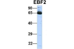 Host:  Rabbit  Target Name:  EBF2  Sample Type:  Human Fetal Lung  Antibody Dilution:  1. (EBF2 antibody  (Middle Region))