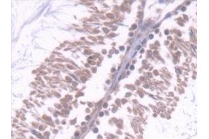 Detection of CD7 in Rat Testis Tissue using Polyclonal Antibody to Cluster Of Differentiation 7 (CD7)