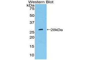 Western Blotting (WB) image for anti-Patched 1 (PTCH1) (AA 227-436) antibody (ABIN1860347) (Patched 1 antibody  (AA 227-436))