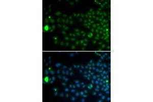 Immunofluorescence analysis of MCF-7 cells using SPDYA antibody. (SPDYA antibody)