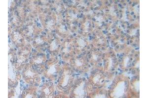 Detection of CEACAM1 in Rat Stomach Tissue using Polyclonal Antibody to Carcinoembryonic Antigen Related Cell Adhesion Molecule 1 (CEACAM1) (CEACAM1 antibody  (AA 36-145))