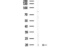 anti-P18 INK antibody