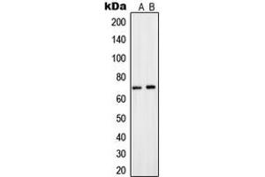 Western blot analysis of CNT2 expression in A549 (A), HepG2 (B) whole cell lysates. (SLC28A2 antibody  (Center))