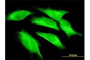 Immunofluorescence of monoclonal antibody to IL15 on HeLa cell. (IL-15 antibody  (AA 49-162))