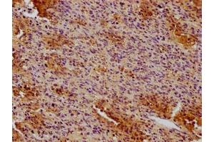 IHC image of ABIN7147134 diluted at 1:100 and staining in paraffin-embedded human spleen tissue performed on a Leica BondTM system. (CD19 antibody  (AA 20-291))