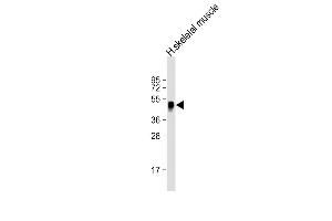 Anti-WNT11 Antibody (Center) at 1:2000 dilution + human skeletal muscle lysate Lysates/proteins at 20 μg per lane. (WNT11 antibody  (AA 166-198))