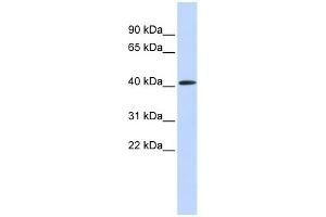 WB Suggested Anti-PAntibody Titration:  0. (PARP11 antibody  (Middle Region))