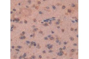 Used in DAB staining on fromalin fixed paraffin- embedded Kidney tissue (FZD1 antibody  (AA 112-317))