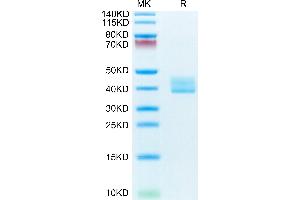 Mouse BCMA/TNFRSF17 on Tris-Bis PAGE under reduced condition. (BCMA Protein (AA 1-49) (Fc Tag))