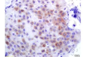 Formalin-fixed and paraffin embedded human placenta labeled with Anti-PLK1 Polyclonal Antibody, Unconjugated (ABIN700435) at 1:200 followed by conjugation to the secondary antibody and DAB staining (PLK1 antibody  (AA 201-300))