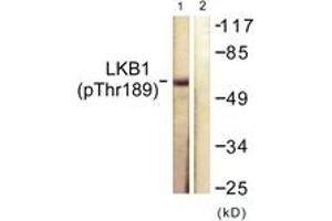 Western blot analysis of extracts from NIH-3T3 cells treated with PMA 125ng/ml 30', using LKB1 (Phospho-Thr189) Antibody. (LKB1 antibody  (pThr189))