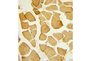 Formalin-fixed and paraffin-embedded human skeletal muscle reacted with EYA4 Antibody (C-term) followed which was peroxidase-conjugated to the secondary antibody, followed by DAB staining. (EYA4 antibody  (C-Term))