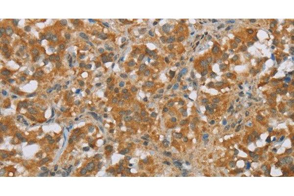 FOXB1 antibody