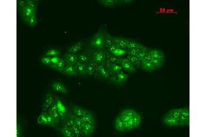 Immunocytochemistry/Immunofluorescence analysis using Rabbit Anti-TNF-R1 Polyclonal Antibody . (TNFRSF1A antibody  (AA 20-43) (PerCP))