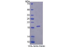 SDS-PAGE analysis of Human PCCa Protein. (PCCA Protein)
