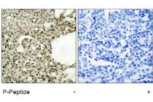 Image no. 2 for anti-Signal Transducer and Activator of Transcription 1, 91kDa (STAT1) (pSer727) antibody (ABIN196892) (STAT1 antibody  (pSer727))
