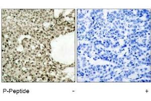 Image no. 2 for anti-Signal Transducer and Activator of Transcription 1, 91kDa (STAT1) (pSer727) antibody (ABIN196893)
