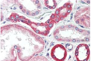 Human Kidney (formalin-fixed, paraffin-embedded) stained with BAK1 antibody ABIN461962 at 20 ug/ml followed by biotinylated goat anti-rabbit IgG secondary antibody ABIN481713, alkaline phosphatase-streptavidin and chromogen. (BAK1 antibody)