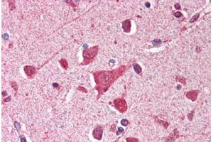 Human Brain, Cortex (formalin-fixed, paraffin-embedded) stained with TP53 antibody ABIN214388 at 2. (p53 antibody)