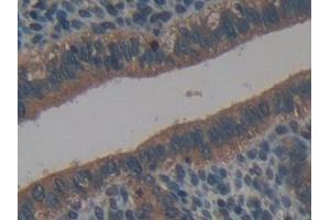 Detection of NB1 in Mouse Uterus Tissue using Polyclonal Antibody to Neutrophil Specific Antigen 1 (NB1) (CD177 antibody  (AA 193-468))